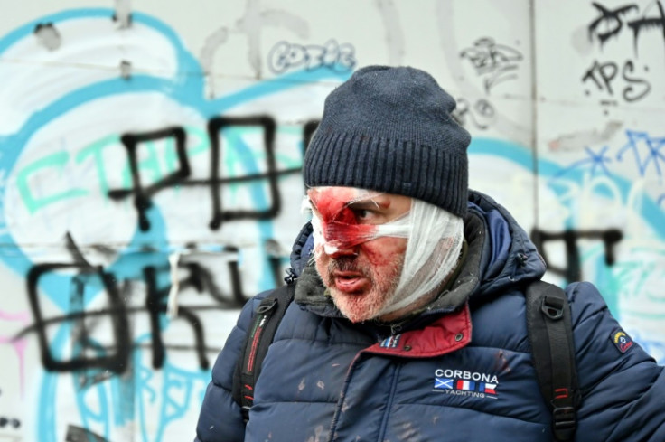 A Russian missile strike on a Kharkiv residential building left several injured