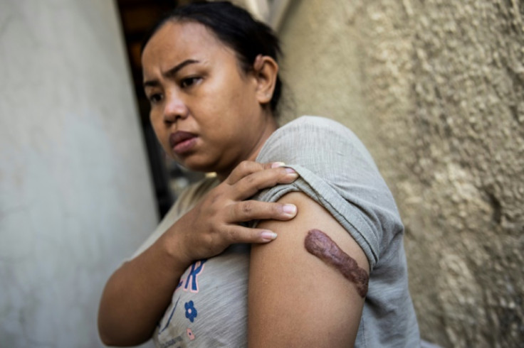 Lawyers said the severity of the injuries limit Kartika's future employment options and that she was never able to afford the medical treatment she needed